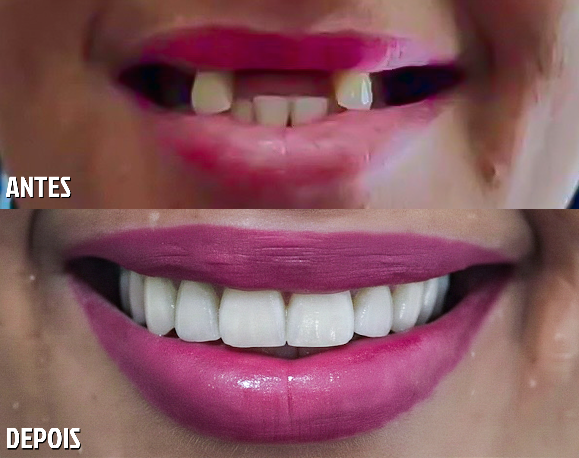 Antes e Depois Odontológico 3